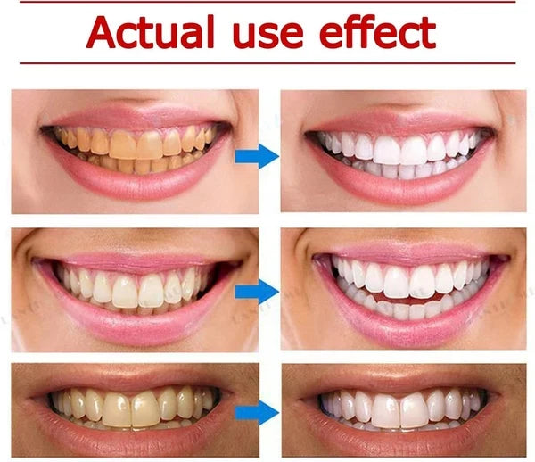Yayashi SP-4 Ultra Whitening Toothpaste 150 ml