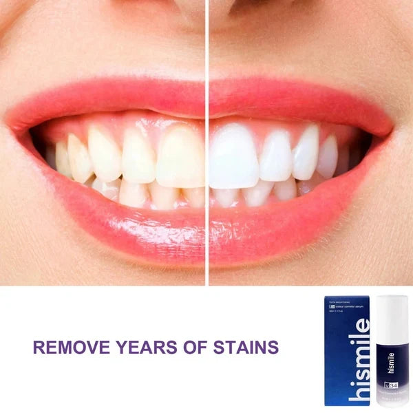 Hismile Purple Teeth Whitening Toothpaste – Oral Care & Bright Smile