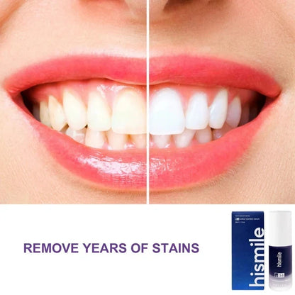 Hismile Purple Teeth Whitening Toothpaste – Oral Care & Bright Smile