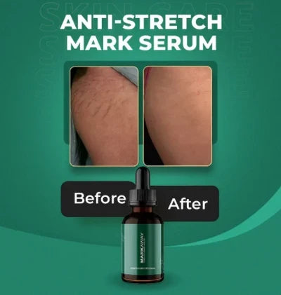 Markaway Stretch Mark Serum 30ml – Herbal Skin Repair & Firming
